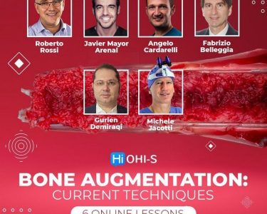 Bone-Augmentation-Current-Techniques.jpg